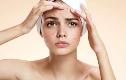 Does Zinc Help With Acne?