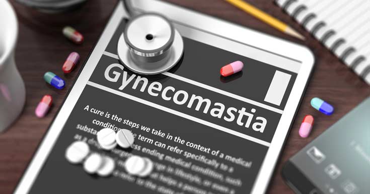 About Gynecomastia