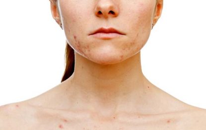 4 Most Dangerous Skin Conditions and their Treatments