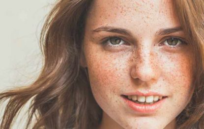 Moles and Freckles: What You Need To Know