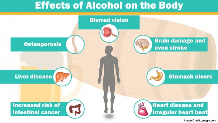 Alcohol Brain Damage