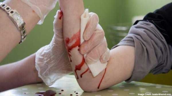 Severe Bleeding