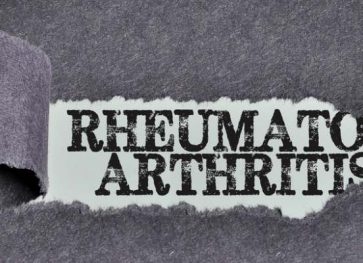Get Incredible 3 Homemade Tips For Rheumatoid Arthritis