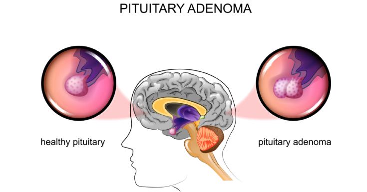 Pituitary Gland