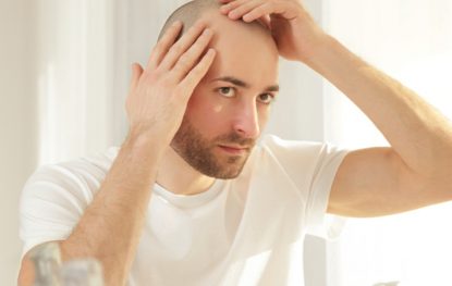 Hair Baldness Treatment – Restore Your Hair and Your Confidence