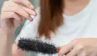 Hair Loss
