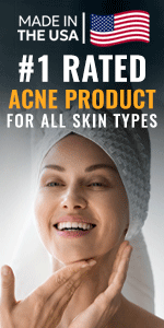 acne-product-reviews