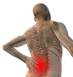 Back Pain