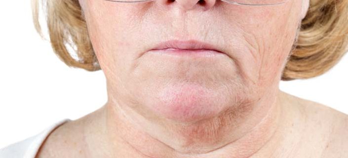 chest wrinkles neck prevention treatments causes facts center