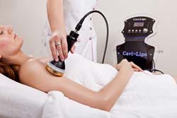 Lipo Cavitation: How Does This Procedure Work?