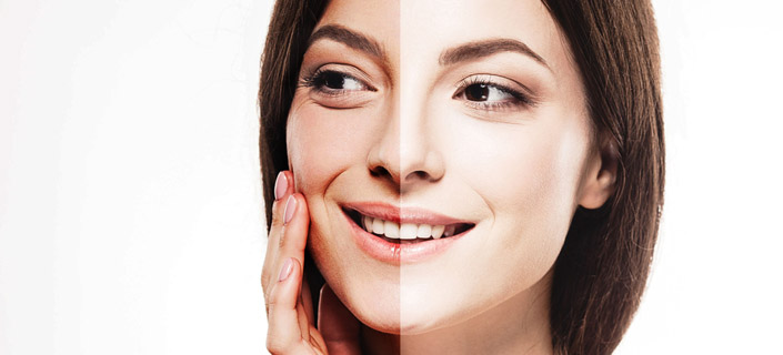 Wrinkles and Tan Skin – Know How Tanning Affects Your Skin