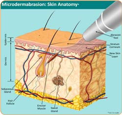 Why Stretch Marks Occurs and How to Get Rid of Stretch Marks Why Stretch Marks Occurs and How to Get Rid of Stretch Marks