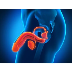 Peyronie's Disease