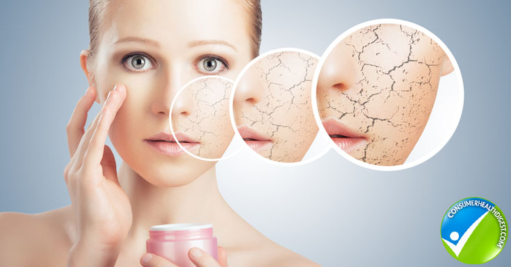What Causes Dehydrated Skin