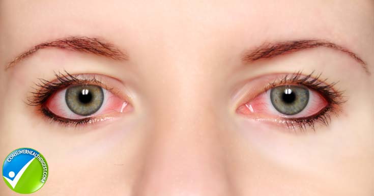 Eyelash Growth Serum - What You Need to Know?