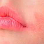 Itchy Burning Lips: 7 Remedies to Try at Home