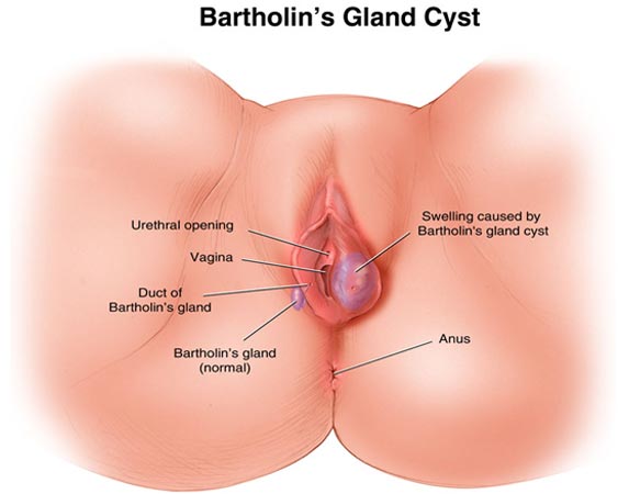 What are some causes of cysts?