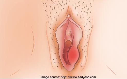 Swollen Clitoris After Sex 100