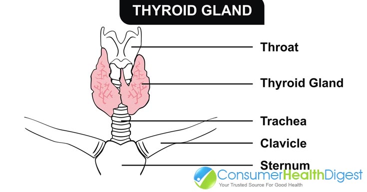 an overview of the causes symptoms and treatment of hypothyroidism an overview of the causes symptoms and treatment of hypothyroidism