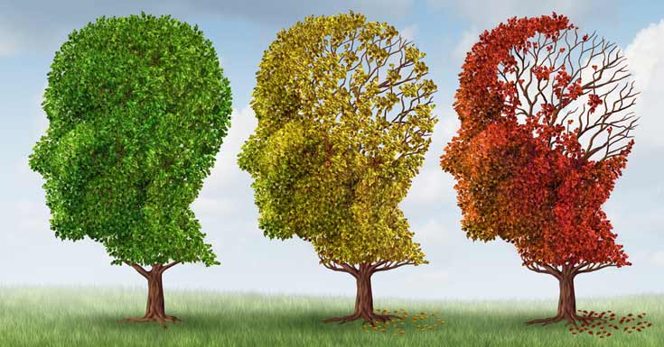 Dementia and Alzheimer's disease