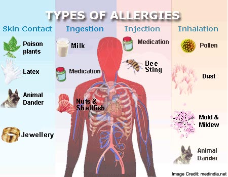 essay on types of allergies