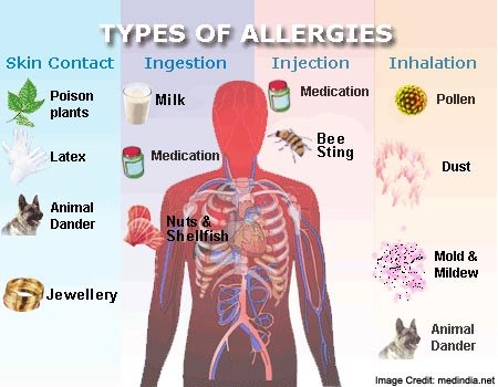 what to do for allergies allergies types symptoms causes risk factor and treatments what to do for allergies allergies types symptoms causes risk factor and treatments
