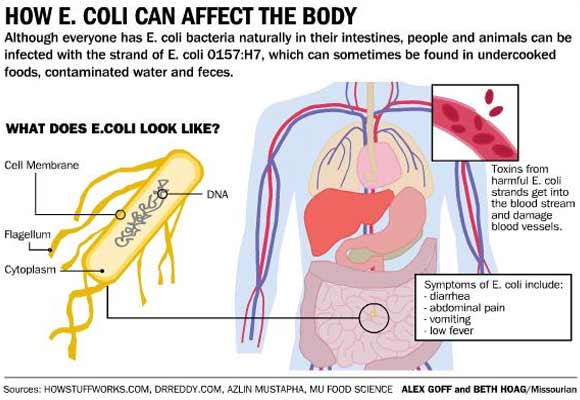 Image result for E.coli death