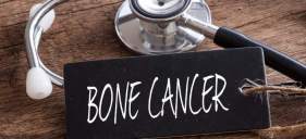 Get The Facts About Bone Cancer (And Causes, Symptoms & Treatment)