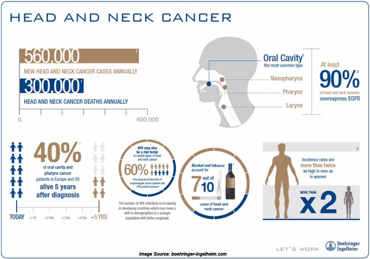 Head And Neck Cancer Diagram