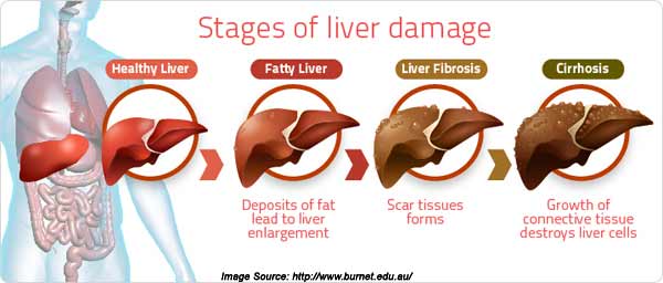 [Image: types-of-liver-cancer.jpg]