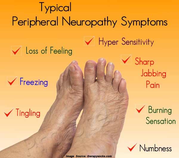 Signs and Symptoms Of Neuropathy