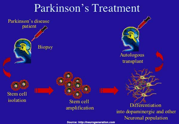 What are some side effects of Parkinson's disease medications?