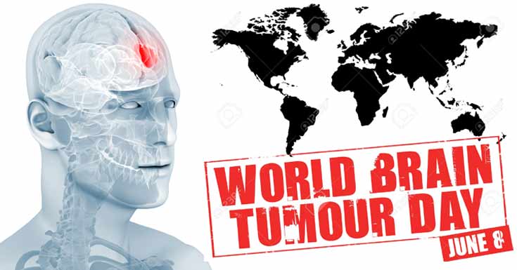 Everything You Need To Know About World Brain Tumor Day