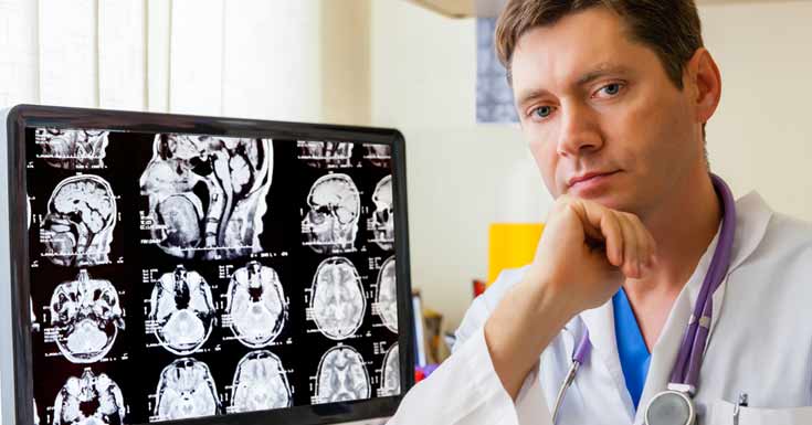 Chemo Brain: Types, Symptoms, Causes, Diagnosis And Treatment