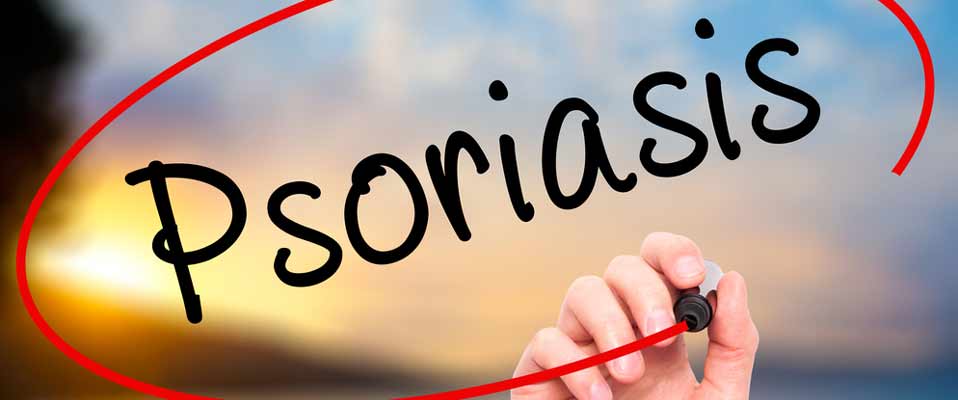 Psoriasis Awareness Month: Educates Public about the Disease