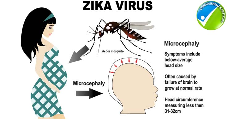 Why Pregnant Women Should Be Cautious About Zika Virus 