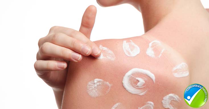 Topical Skin Treatment