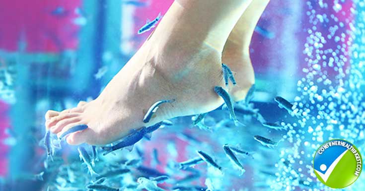 Treatment options for Athletes Foot