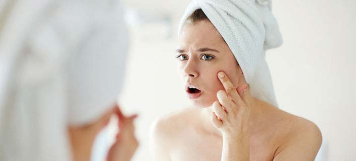Everything You Need To Know About Acne