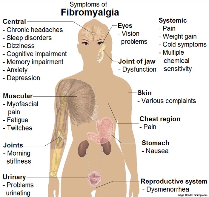 Fibromyalgia info