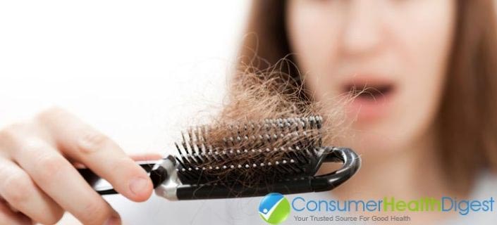 Everything You Need To Know About Hair Loss: From Causes To Treatments