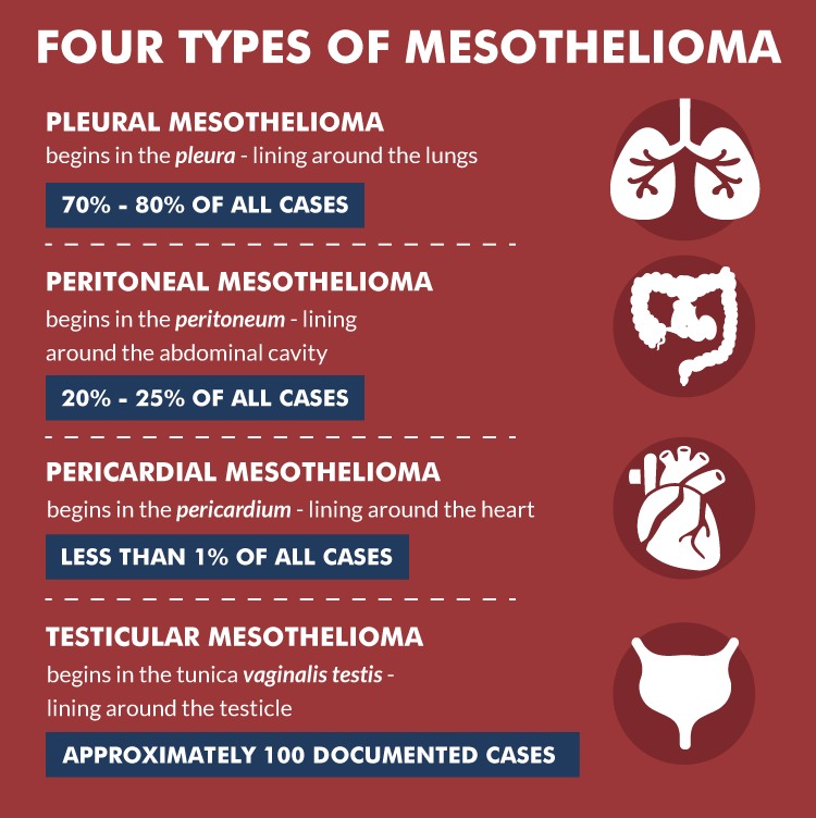 mesothelial hyperplasia vs mesothelioma