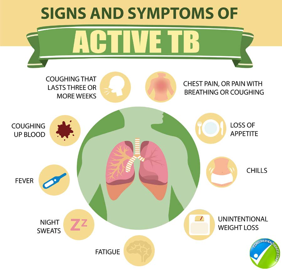 Tuberculosis Symptoms And Measures Infographics Vector Image