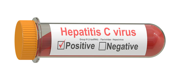Hasil gambar untuk hepatitis c