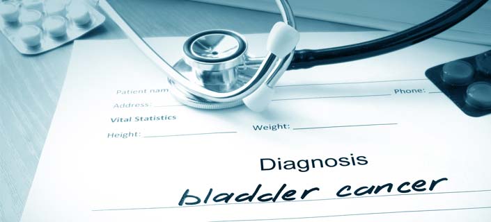 What is Bladder Cancer – Everything You Need To Know