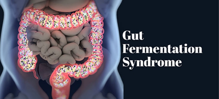 What are the Conditions of Gut Fermentation? More About This Syndrome