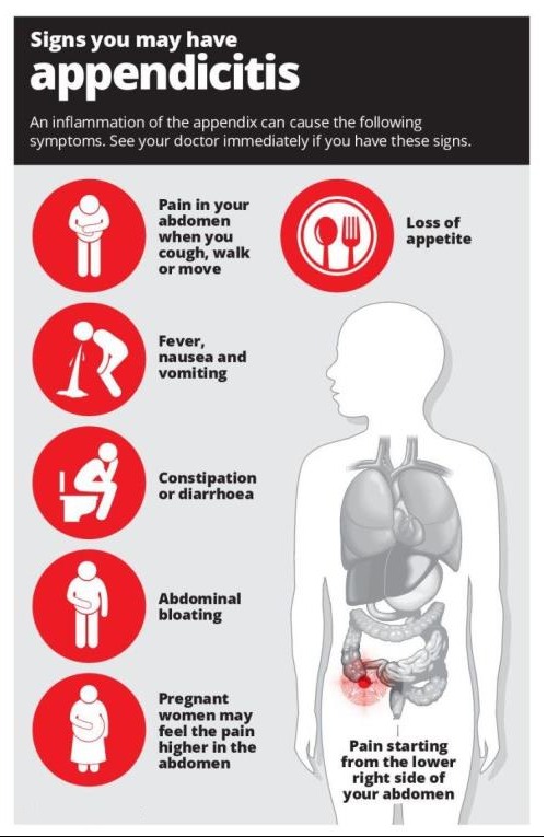 Causes of Appendicitis