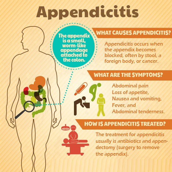 Symptoms And Treatment Of Appendicitis