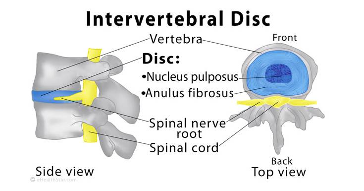 Intervertebral Discs