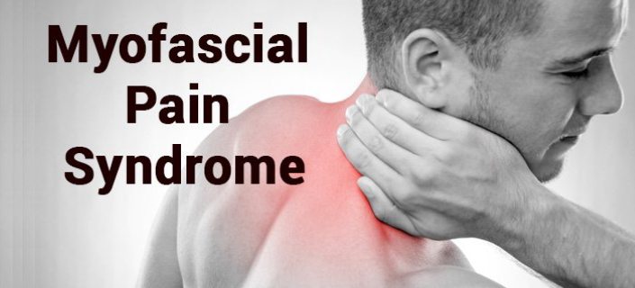 Myofascial Pain Syndrome - Causes, Signs, Symptoms & Treatment